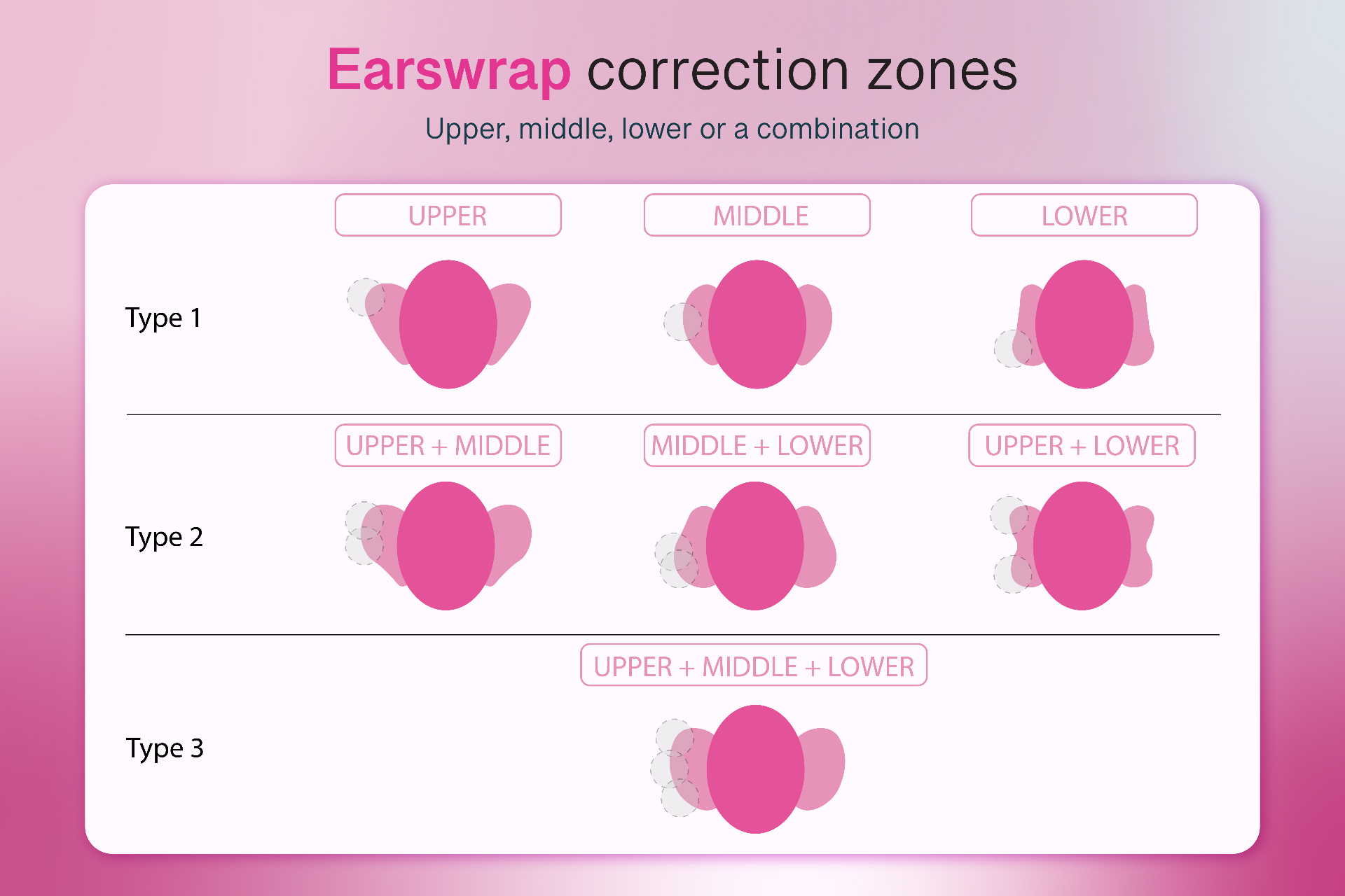 Earswrap compared with visible ear stickers, tape and clip-on ear correction devices